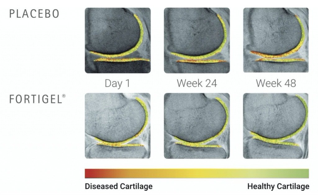 Collagen Effects