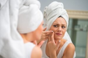 Best Vitamins For Acne