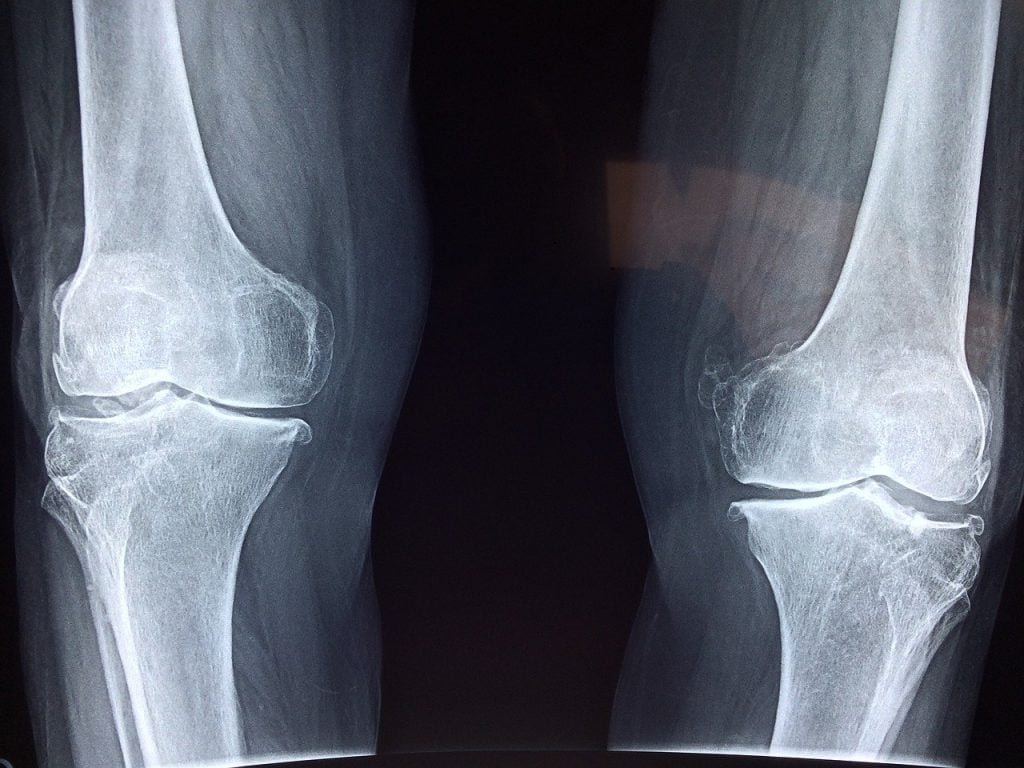 Medix Select Limbex for bones