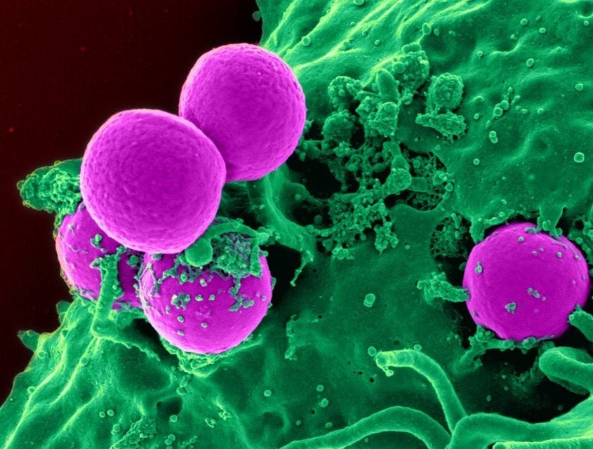 Bacteria